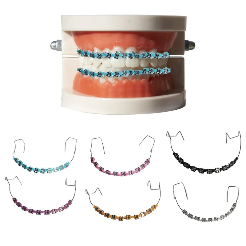 Dental braces model with blue brackets and various colored orthodontic braces options