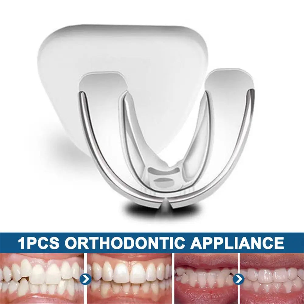 White orthodontic appliance and before-after teeth alignment comparison images